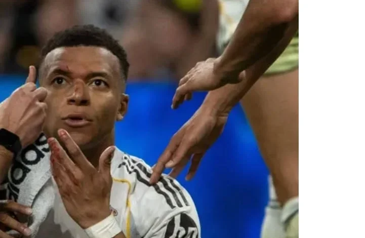 آخر أخبار إصابات ريال مدريد 2026 : آخر أخبار إصابة كيليان مبابي، رودريغو، وتيبو كورتوا